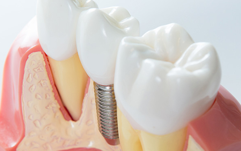 耐久性が高く、長持ちする
